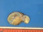 8 NMSP Circulation A21 - Bone case B9.jpg